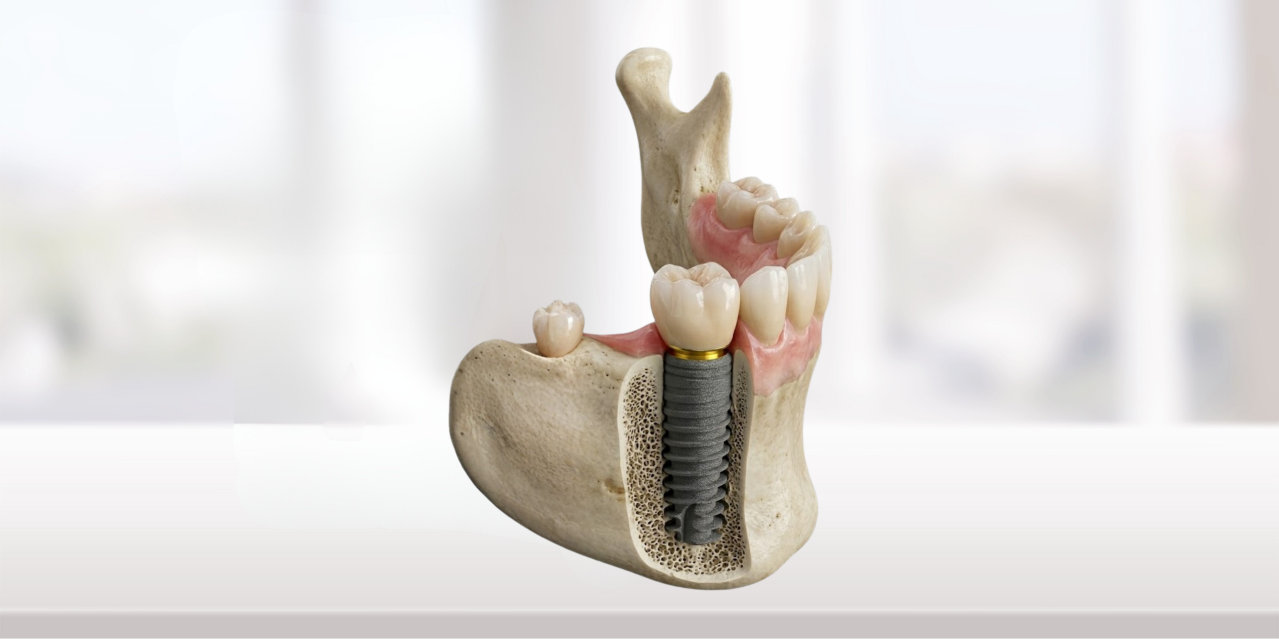 Biyomateryal